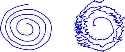 Discrete Cosine Transform for the Analysis of Essential Tremor